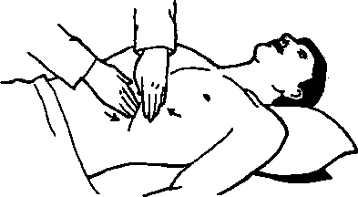 Рис. 15.12. А. Селезенка пальпируется бимануальным методом. Пациент лежит на спине, а врач располагается справа от него. Левая рука врача расположена на левой реберной дуге, а правая пытается нащупать селезенку. (Приводится с разрешения из: Yang J. С., Rickman L.S., Bosser S.K.: The clinical diagnosis of splenomegaly. West J. Med. 155: 47-52, 1991)