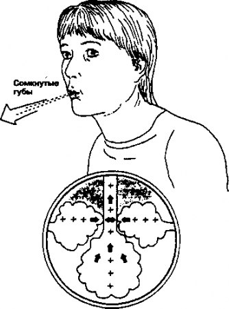 Рис. 13.1. Дыхание через сомкнутые губы при ХОЗЛ и его влияние на легкие. Благодаря тому, что губы при выдохе сомкнуты, давление воздуха оказывается повышенным, и мелкие бронхи не закрываются (Приводится с разрешения из: НШе gass Е.А., Sadowsky H.S. (eds): Essentials of Cardiopulmonary Physical Therapy. Philadelphia, W.B. Saunders, 1994)