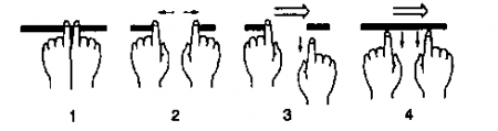 Рис. 15.7. Методика определения направления кровотока по поверхностным венам. Врач пережимает указательными пальцами кровоток по вене (1). Затем раздвигает указательные пальцы, выдавливая кровь из промежуточного сегмента вены (2). Давление на один конец вены прекращается и засекается время, за которое кровь заполнит пустующий сегмент вены (3). Процедура повторяется снова, только вначале убирается палец с другой стороны (4). Кровоток направлен в сторону более быстрого заполнения. (Приводится с изменениями из: De Gowin R.L.: De Gowin and De Gowins Diagnostic Examination, 6th ed. New York, McGrow-Hill, 1994)