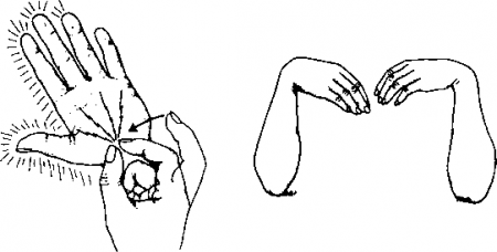 Рис. 22.5. Симптом Тинеля (слева) и признак Фалена (справа). (Приводится с разрешения из: The Hand: Examination and Diagnosis, 3rd ed. New York. rhirchill Livingstone, 1990)