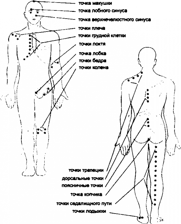 Vista frontale e di spalle di una persona ed i suoi muscoli con i trigger points