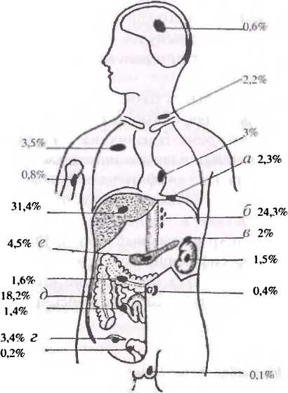 Рис. 38. Частота отдаленных метастазов при раке желудка: а - диафрагма; 6 - забрюшинные лимфоузлы; в - надпочечник. г - яичник, д - брюшина е - поджелудочная железа