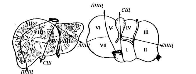 Рис. 62. Долевое и сегментарное строение печени: СЩ - срединная щель; ППЩ - правая портальная щель; ЛПЩ -левая портальная щель; I-VIII - сегменты печени
