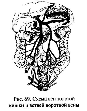 Рис. 69. Схема вен толстой кишки и ветвей воротной вены